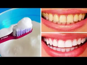 How Your Diet Affects Your Teeth: Foods for a Brighter Smile & Natural Teeth Whitening Tips