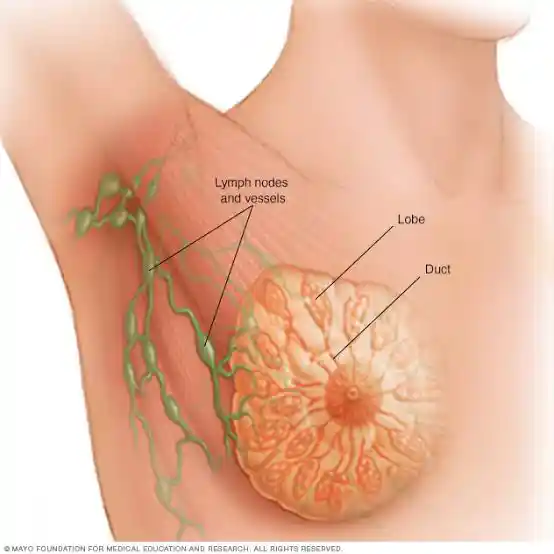 Breast Cancer: Early Signs and How to Perform Breast Self-Examination