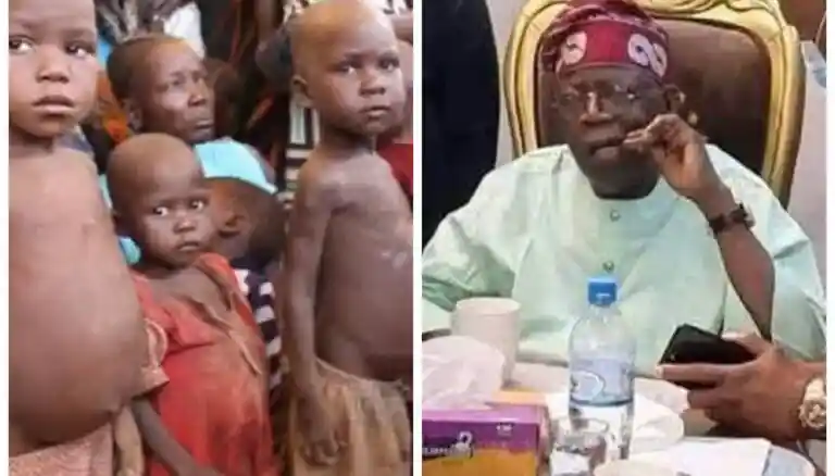 Nigeria Now Has More Malnourished Children Than War-Torn Sudan – UNICEF
