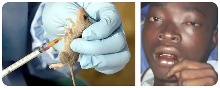 Lassa Fever In Nigeria