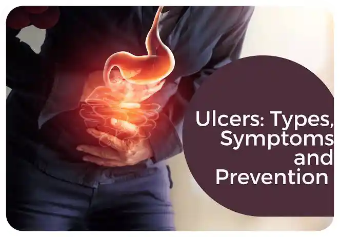 Ulcer in Nigeria: Causes, Types, Diet, and Effective Management