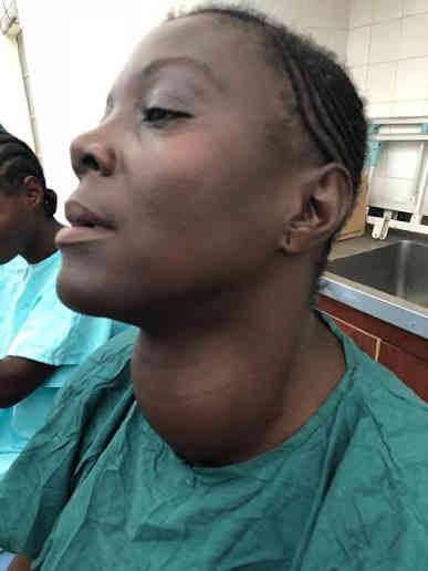 Thyroid Disorders in Nigeria: